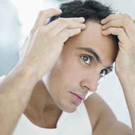 Reasons Why Men are Balding in Their 20s