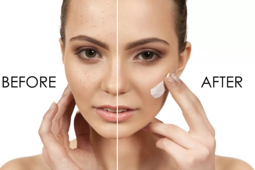 6 Magical Beauty Benefits Of Plum You Might Have Never Heard About