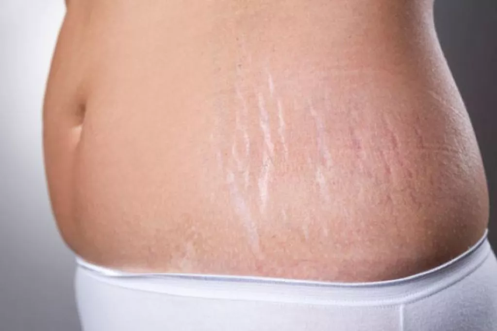 Most Common PostPregnancy Skin Problems And How To Tackle Them