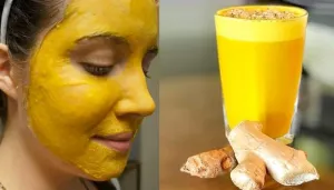 13 Benefits Of Turmeric Milk (Haldi Doodh), From Glowing Skin To Healing Joint Pains