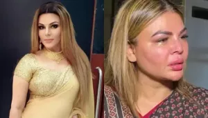 Rakhi Sawant Has Tumour In Uterus, Reveals Her Ex-Husband, Riteish, 'Admitted To The Hospital...'
