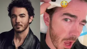 A Mole On Kevin Jonas' Forehead Turns Out To Be Skin Cancer, He Undergoes Surgery To Get Rid Of It
