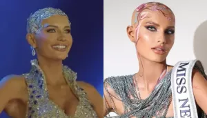 Who Is Mary Sickler? First Miss USA Contestant With Alopecia To Ditch Her Wig In Preliminary Round