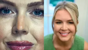 Karoline Leavitt's Before And After Vanity Fair Shoot Pics Made Fans Ask 'Are Those Lip Fillers?'