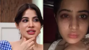 'The Traitors' Winner, Urfi Javed Goes Under The KNIFE To Lessen Chin, Lip Fillers, 'Kum Hai..'