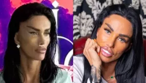 Katie Price Looks Unrecognisable After 'Fox Eye' Face Lift, Spotted In Turkey After More Surgeries