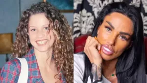 Katie Price's Complete Plastic Surgery Journey, Admitted Addiction To Procedures, Had Ears Pinned