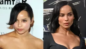 Amid Harry Styles Dating Buzz, Zoe Kravitz's Before-And-After Pics Spark Buccal Fat Removal Rumours