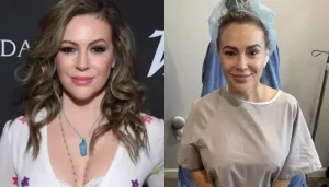 Alyssa Milano Removes Her Breast Implants At Age Of 52, Says, 'Letting Go Of What Was Never Me..'