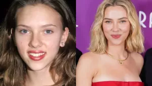 Scarlett Johansson's Before-And-After Pics Resurface Amid Her Stunning Ray Gunn Premiere Appearance