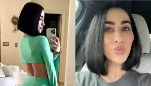 Stephanie Buttermore Spoke On Her Weight Gain And Body Image After Vein Leg Ablation Surgery