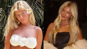 21-Yr-Old Influencer Spent USD 16K On Cosmetic Surgeries, From Lip Fillers To Breast Implants