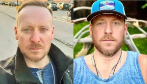 Tyler Duckworth's Cause Of Death, 'The Challenge' Champion Had A Surgery Before His Passing At 44