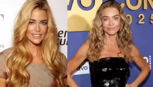 Denise Richards Was 'Scared' Of Facelift, Says Ex Aaron Tried To Leak Pics, Said 'It's Botched'