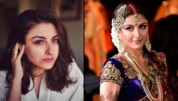 Expert Tips For Brides To Get Rid Of Facial Scars