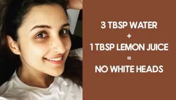 5 Homemade Face Masks To Get Rid Of Whiteheads Quickly