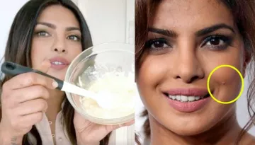 8 Surprising Beauty Benefits Of Curd For Problem Free Skin And Hair