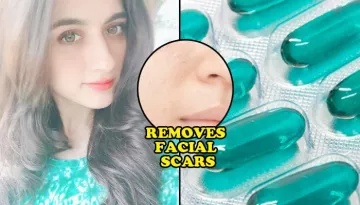 This Evion Vitamin E Capsule Is The BFF That Your Skin Has Been Looking For; Unheard Beauty Benefits