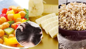 7 Super Foods That Are Effective In Treating Dandruff Naturally