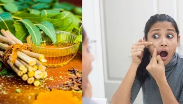 3 Homemade Neem Face Masks For Pimples, Acne And Blemishes
