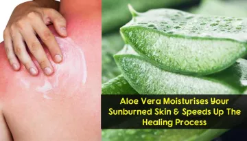 15 Simple Things You Can To Do Get Instant Relief From Sunburn