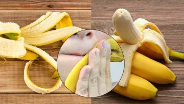 Banana Peel Uses: Treat Acne And Other Skin Conditions With Banana Peels