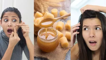 11 Amazing Beauty And Health Benefits Of Jaggery (Gur) That You Might Not Know