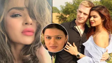Aashka Goradia Reveals How Hubby Brent Goble Inspired Her To Open Up About Her Lip Surgery