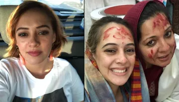 Yuvraj Singh's Wife, Hazel Keech Undergoes A Nose Surgery And Thanks Mother-In-Law In Heartfelt Post