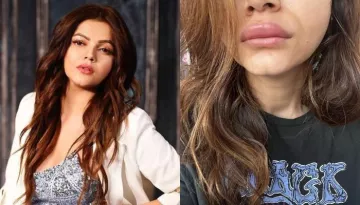 Rubina Dilaik Drops Unedited Pics Of Her 'Duck' Face, Looks Unrecognisable With Swollen Eyes And Lip
