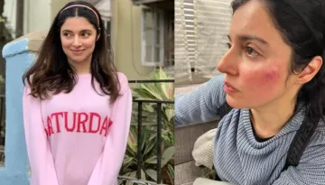 Divya Khosla Kumar Trolled For Sharing Injury Pictures, Internet Reacts 'Apne Babu Se Foo Karwa Lo'