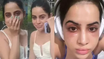 Uorfi Javed Got Under Eye-Fillers After Facing Severe Trolling For Dark Circles: 'Why Did I Do This'