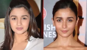 Alia Bhatt's Chubby To Hot Babe Transformation Stuns Fans, Netizen Says 'It's Buccal Fat Removal'
