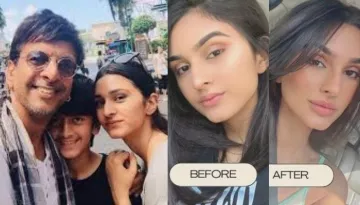 Jaaved Jaaferi's Daughter, Alaviaa Gets Hugely Praised For Revealing Her Lip And Under-Eye Filler