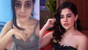 Uorfi Javed Recalls How A Doctor Ruined Her Face Terribly With Uneven Lip Fillers '1 Saal Taak Me..'