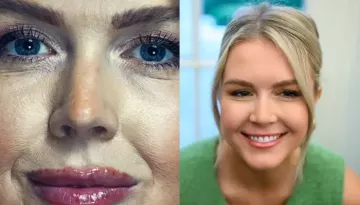 Karoline Leavitt's Before And After Vanity Fair Shoot Pics Made Fans Ask 'Are Those Lip Fillers?'