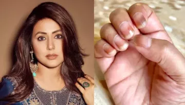 Hina Khan Resolves Mystery About Dis-coloured Nails, Replies To People's Queries, 'How Can I Pray..'