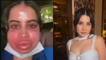 Uorfi Javed's Lip Fillers Get Dissolved After Nine Years, Netizens Say, 'Mazak Banane Wale Gawar..'