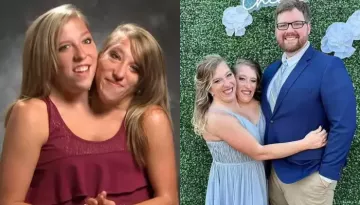 Meet Abby And Brittany Hensel: Two Degrees, One Paycheck, Navigating Marriage As Conjoined Twins