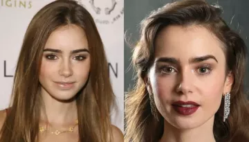 Did Lily Collins Get Cosmetic Surgery? Before-And-After Photos Spark Buzz Amid 'Bone Diet' Claims