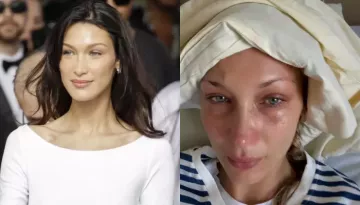 Inside Bella Hadid's Battle With Lyme Disease, All About Her Recent Photo Dump That Worried Fans