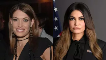 Kimberly Guilfoyle's 'Mar-A-Lago Face', Cosmetic Treatments In Focus Amid USD 100K Donor Scandal