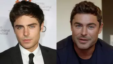Zac Efron's Before-And-After Photos Track His Transformation Amid His Plastic Surgery Rumors
