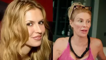 Brandi Glanville's Before-And-After Pictures Resurface Amid Her Decision To Go Under The Knife