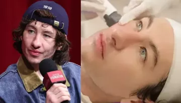 Barry Keoghan's Old Photos Surface Amid USD 6K Beauty Treatment After Facing Abuse Over His Looks
