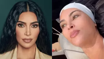 Kim Kardashian Spends USD 3.5K On Cosmetic Procedure, Reacts To Rumors Of Getting A Facelift