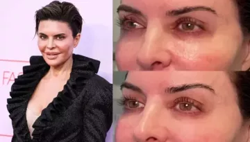 Lisa Rinna's Cosmetic Procedure Was Tagged As 'Botched' By Fans, It Made Her 'Look Freakish'