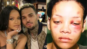 Rihanna Once Became The Poster Child Of Domestic Abuse, Her Bruised Face Surfaced All Over The Media