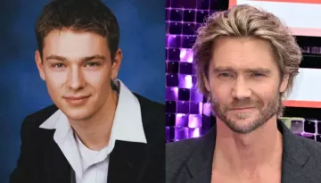 Chad Michael Murray's Fans Remained Stunned With His Pics From Before Nose Injury Changed His Face