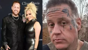 Why Did Jelly Roll Visit Hospital A Week Before His Divorce From Bunnie Xo? 'I Was Puffy-Faced'